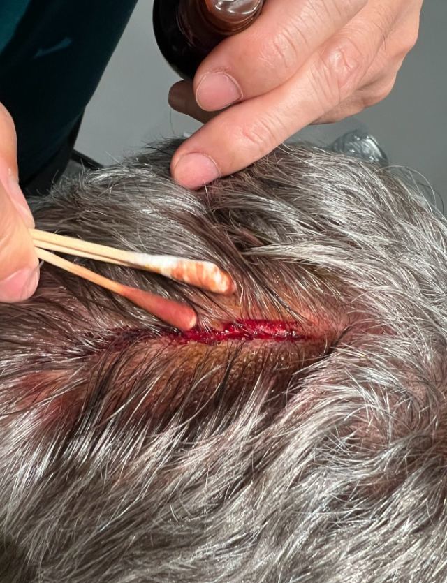 飞溅的碎片, 塞蒂恩继续, 并未受到这 飞溅的碎片, 塞蒂恩继续, 并未受到这